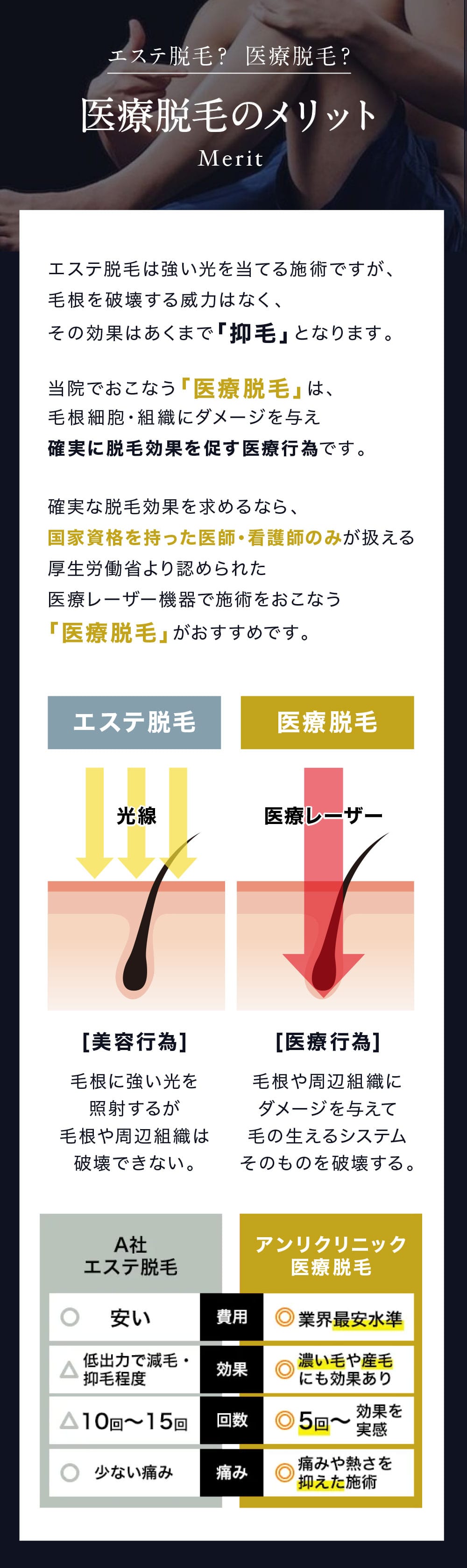 医療脱毛のメリット